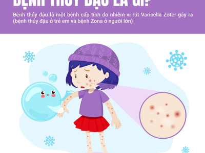 NHỮNG ĐIỀU CẦN BIẾT VỀ BỆNH THỦY ĐẬU