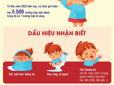 BÀI TUYÊN TRUYỀN PHÒNG CHỐNG BỆNH TAY CHÂN MIỆNG